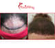 Slider image (10) MAXIM Hair Restoration Turkey
